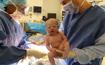 Caesarean Section – what to expect